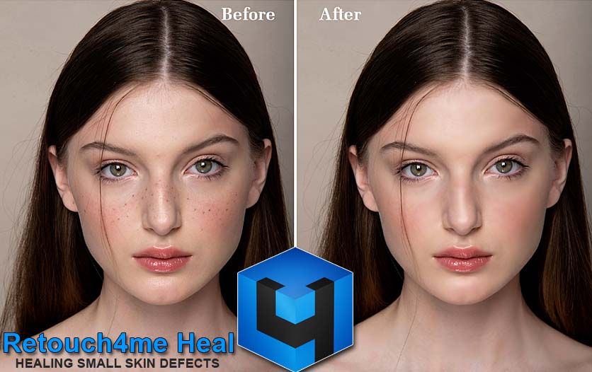 Retouch4me Heal Full Version